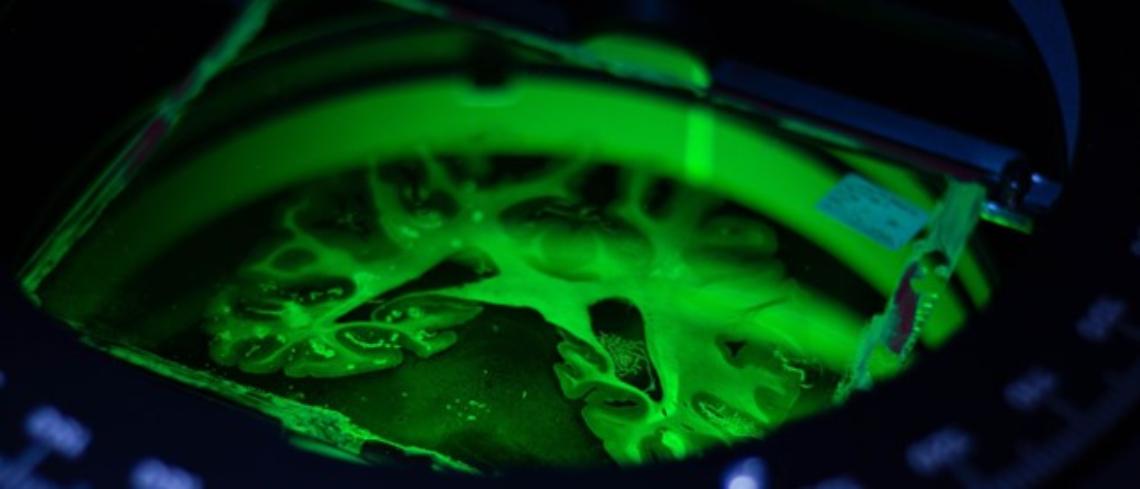 The Ebrains-Italy Research Infrastructure for Neuroscience challenges, due giorni di workshop