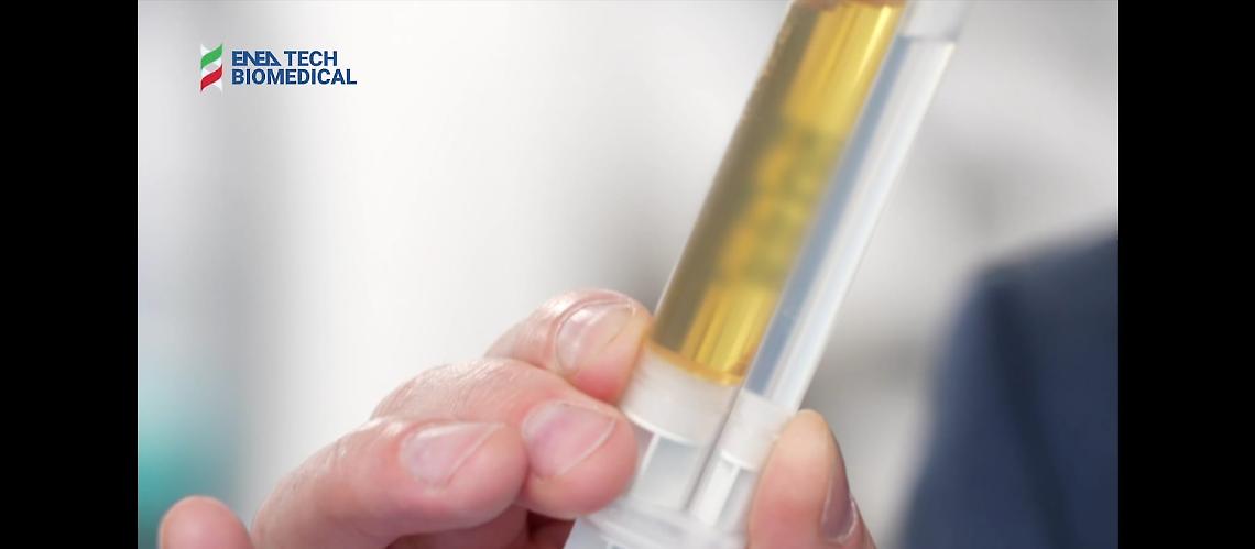 Fondazione Enea-Tech e Biomedical: investimento in progetto di radioterapia innovativa per il trattamento tumori solidi inoperabili