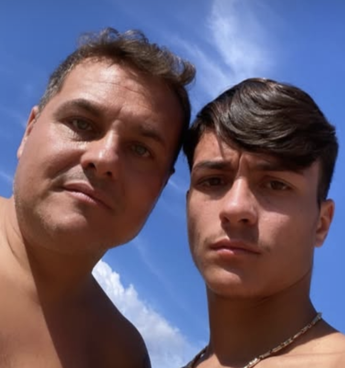 Agguato alla Sanità, uno dei feriti è il fratello dell'attore di “Mare fuori"