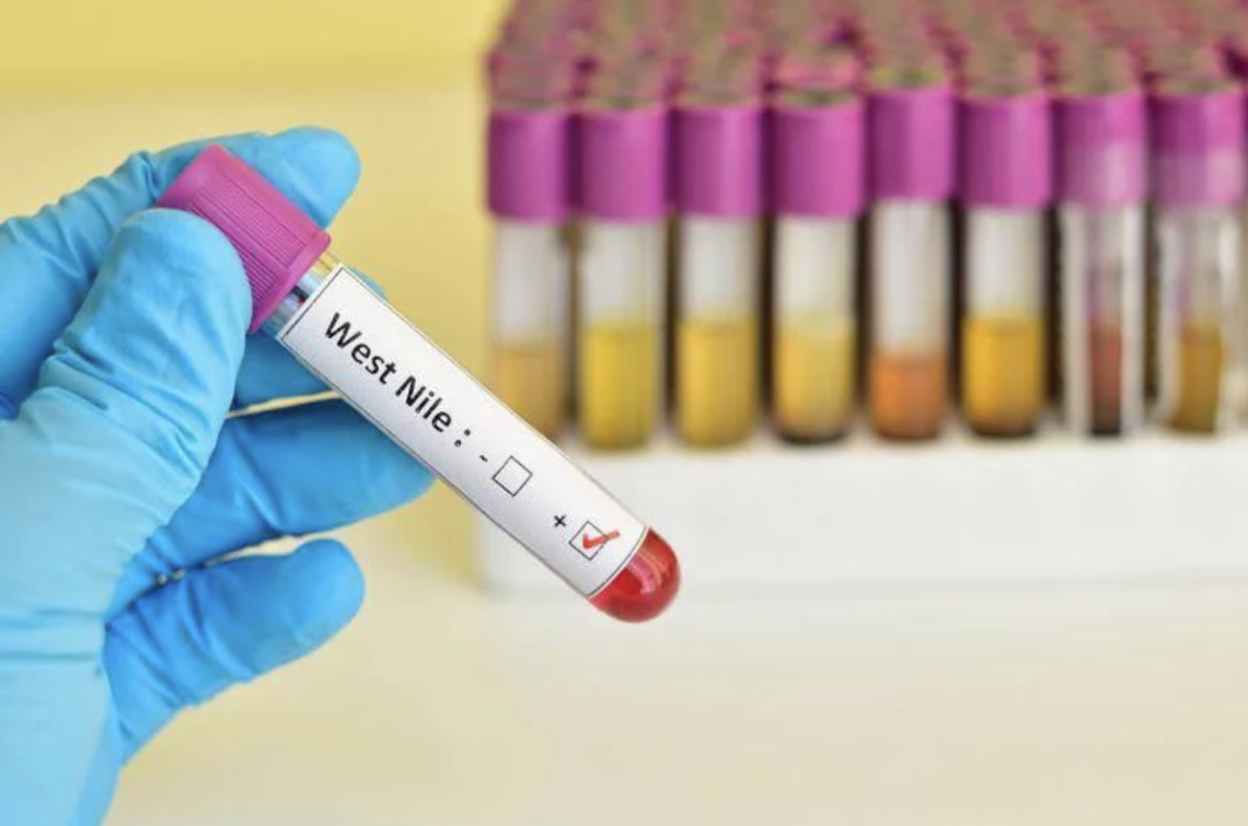 West Nile, tre persone infette nel Casertano: due ricoverate