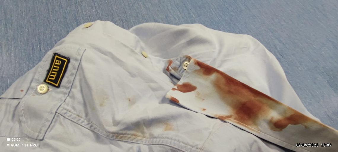 Controllore pestato a sangue, aggressore arrestato