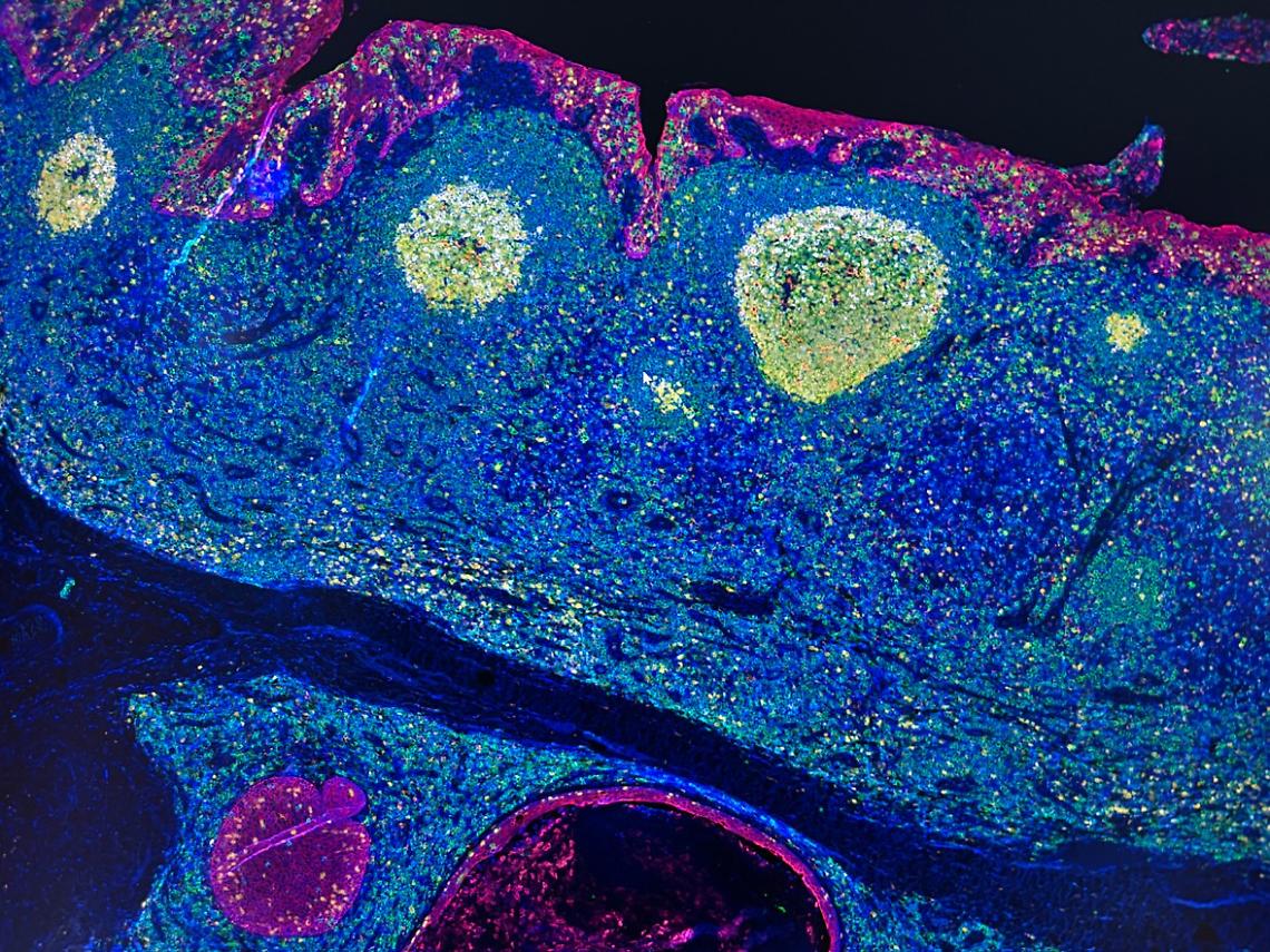 Tumori, &ldquo;mappa Gps" delle cellule rivoluziona l'immunoterapia