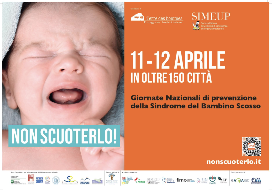 Sindrome del bambino scosso, fatale in un caso su quattro