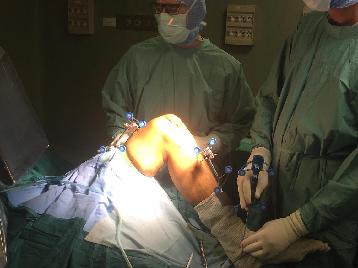 Ortopedia, all'ospedale Betania primo intervento chirurgico con robot