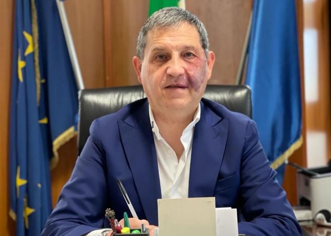 Schiano di Visconti: «Sicurezza inesistente, il Napoletano come il Far West»
