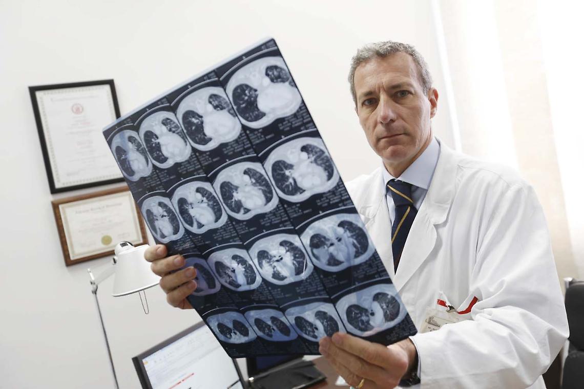 Policlinico Federico II, guarita da leucemia nonostante infetta da Covid