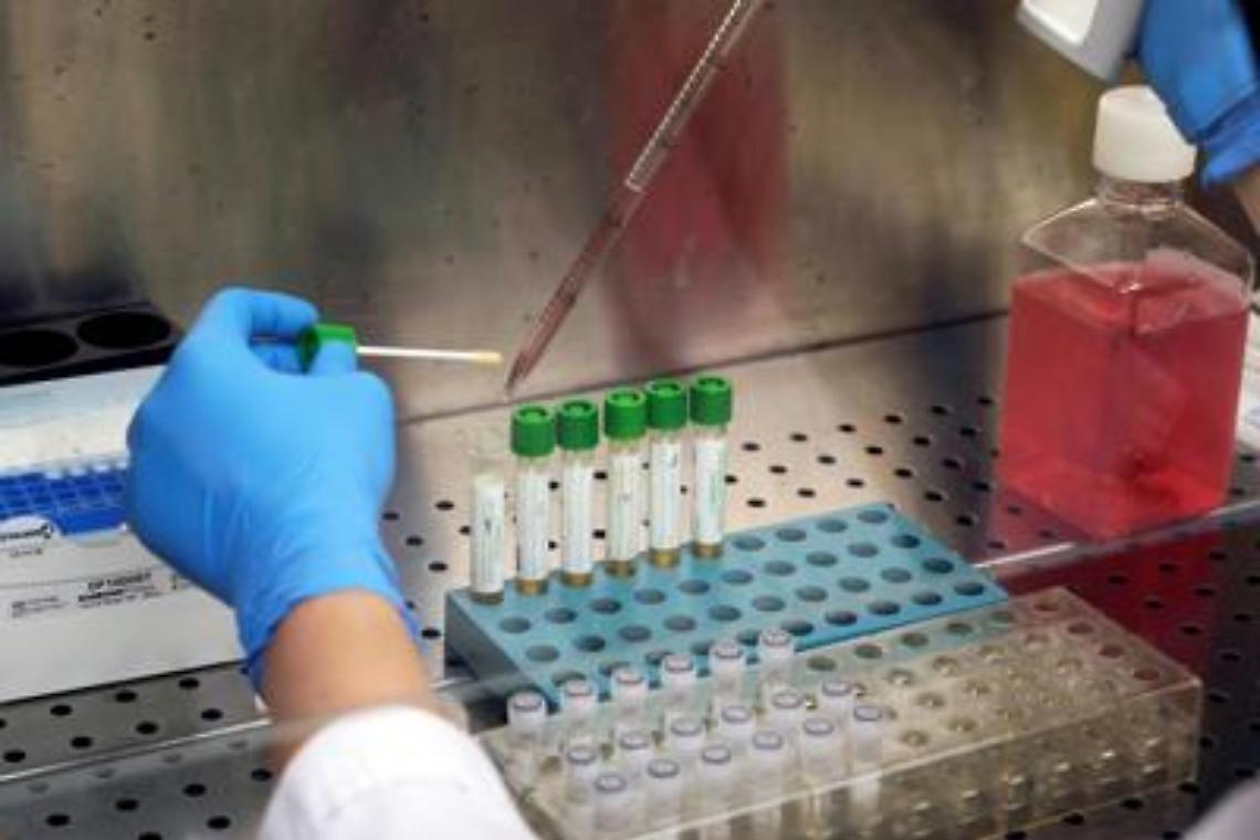 Coronavirus, ministero Salute: «Test rapidi anticorpi non attendibili»
