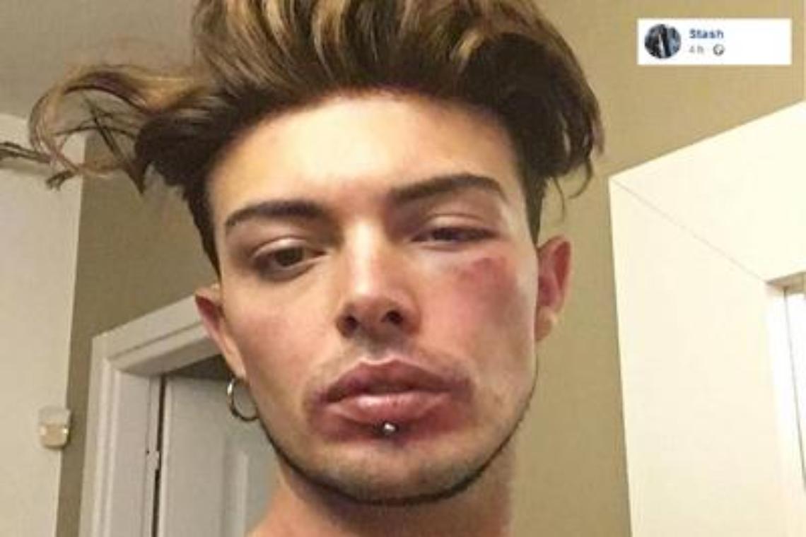 Rissa per difendere una ragazza, lo sfogo di Stash