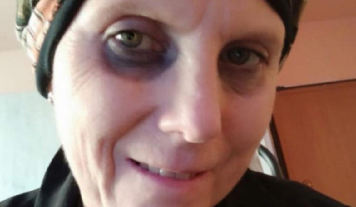 Daniela, malata di cancro cercava la madre biologica per curarsi: la donna ha accettato di aiutarla