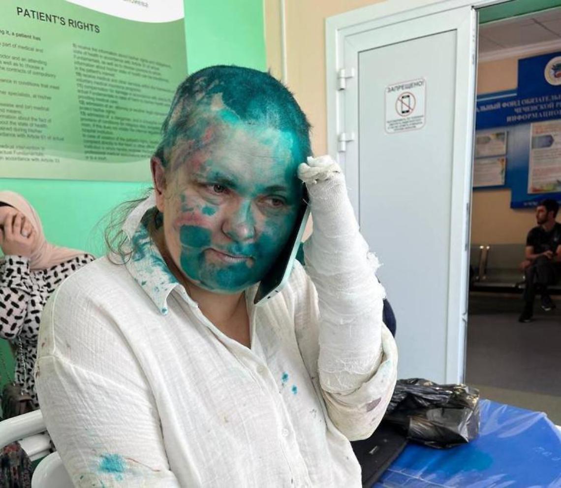 Giornalista e avvocato aggrediti e picchiati in Cecenia