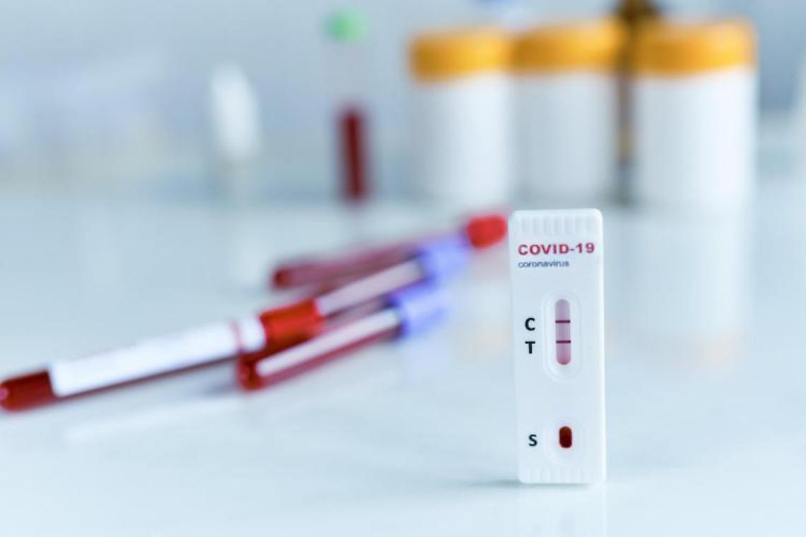 Covid, in Campania +11,9% di nuovi casi