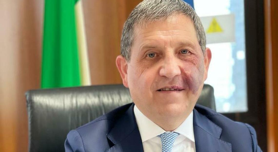 Circumm Schiano (FdI): situazione terrificante, al capolinea