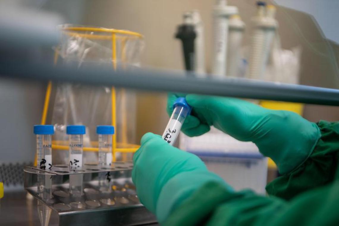 Covid, l'antiparassitario può bloccare danni ai polmoni
