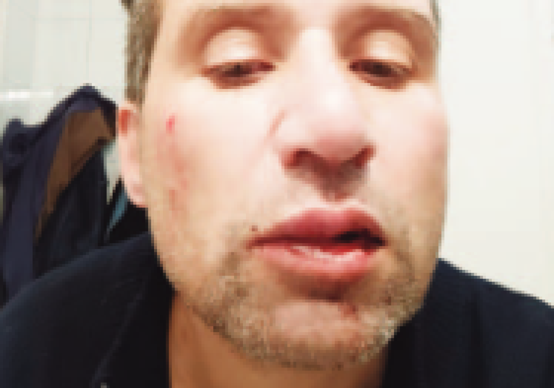 Violenza urbana, pestato a sangue perché va piano con lo scooter
