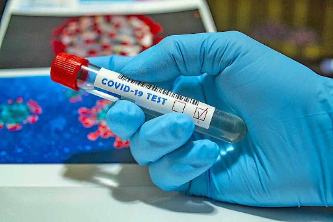 Coronavirus, altri 412 casi e 6 morti