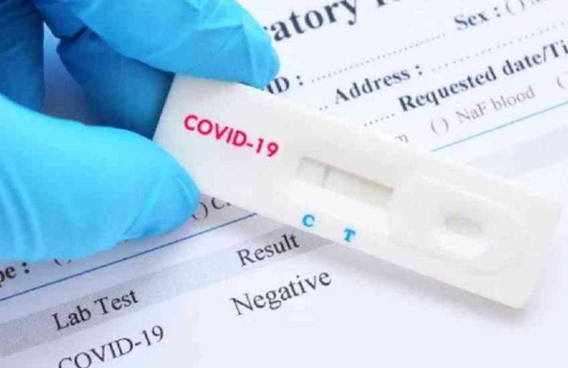 Napoli, Comune-farmacisti: test gratuiti per cittadini
