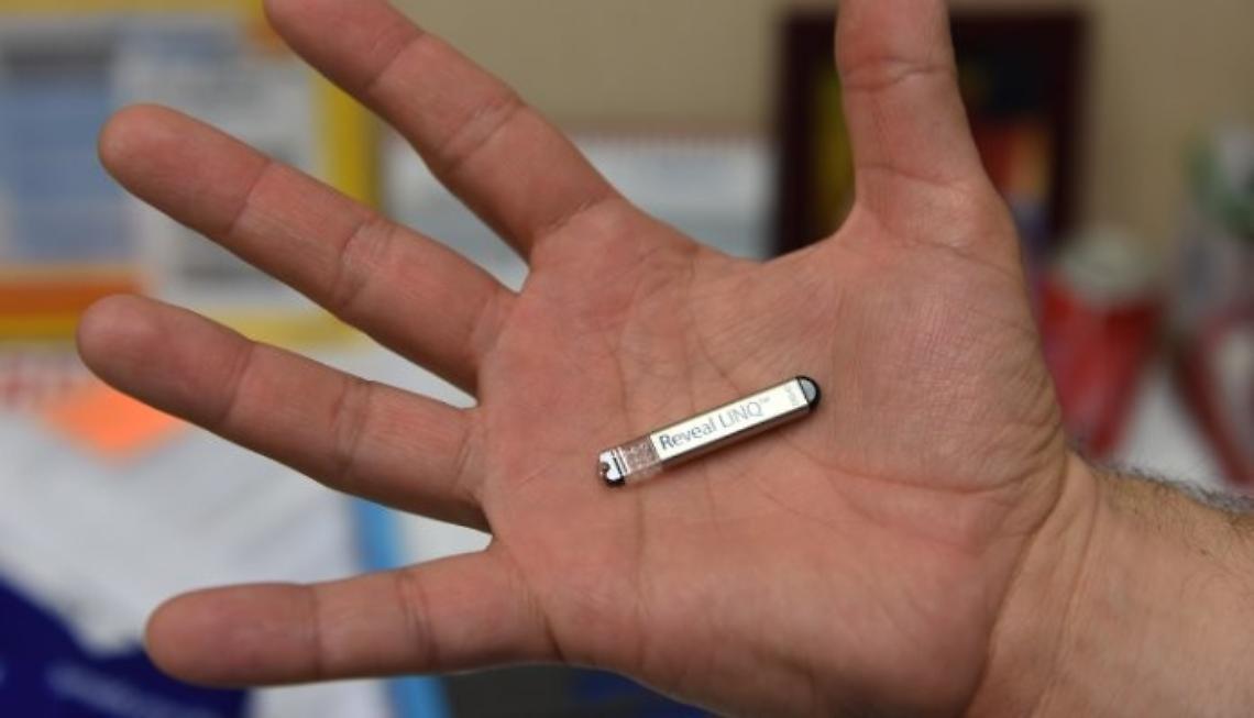 Santobono, siringa sotto cute per monitorare il cuore dei piccoli cardiopatici