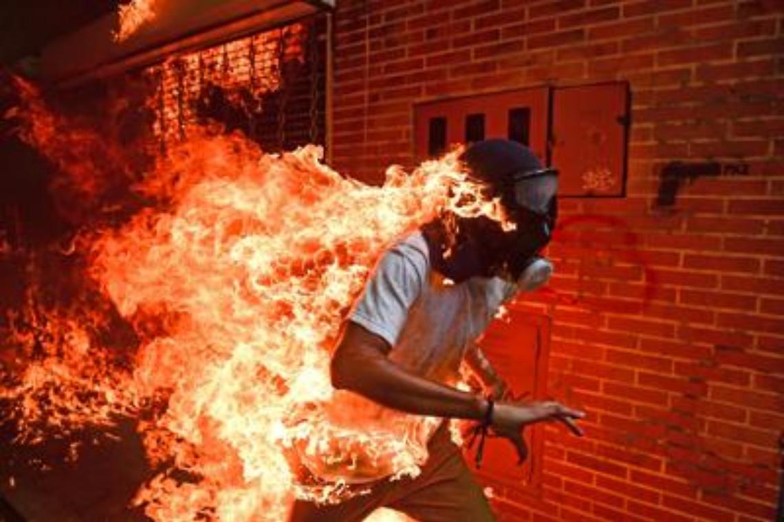 Il ragazzo in fiamme è la foto dell'anno