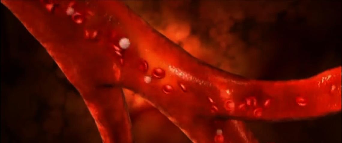 Trombosi, un morto ogni 37 secondi. Sintomi e come prevenirla 