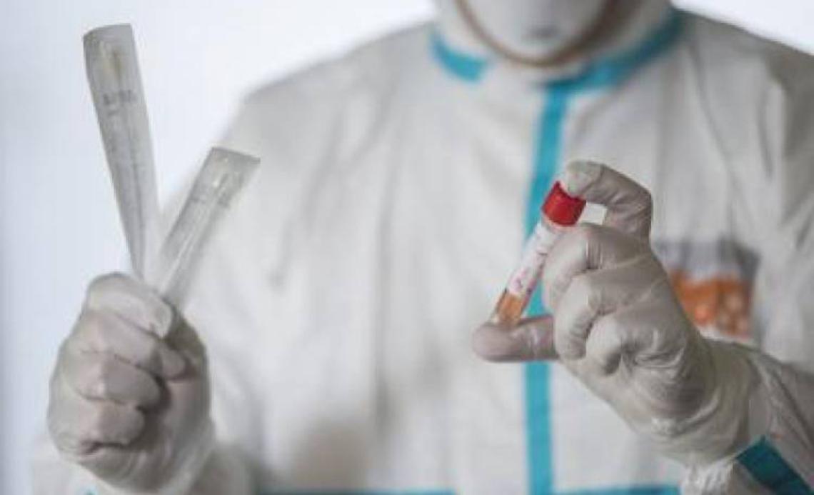 Coronavirus, in Italia 153 morti nelle ultime 24 ore
