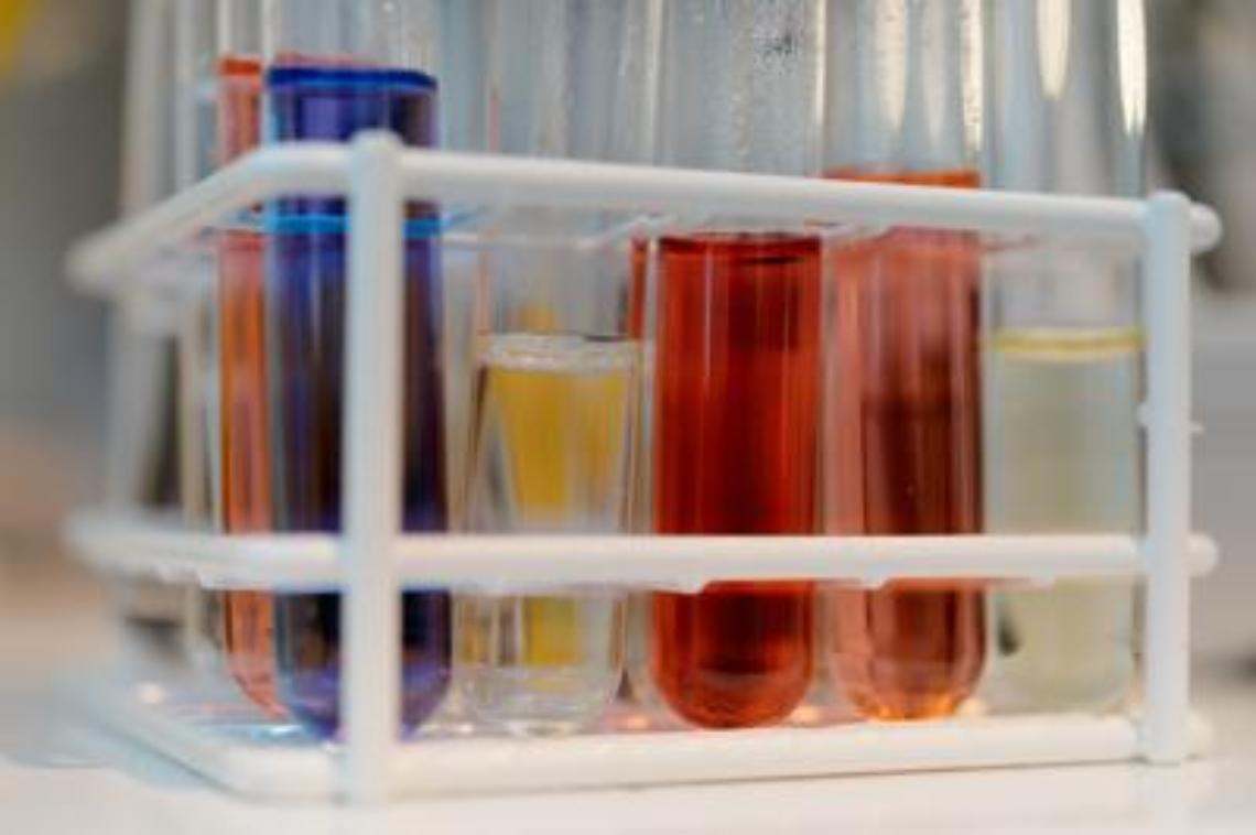 Un test del sangue per scoprire l'Alzheimer