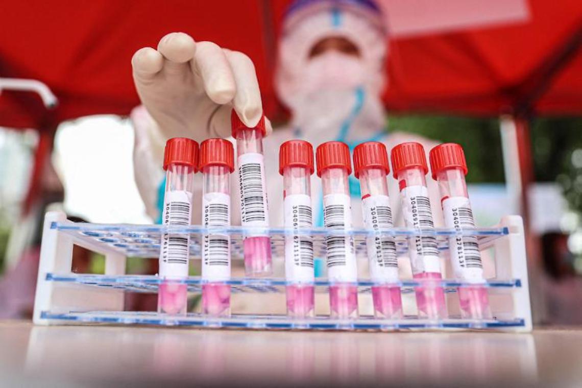 Omicron è più resistente ai disinfettanti, sopravvive sulla plastica 8 giorni: lo studio