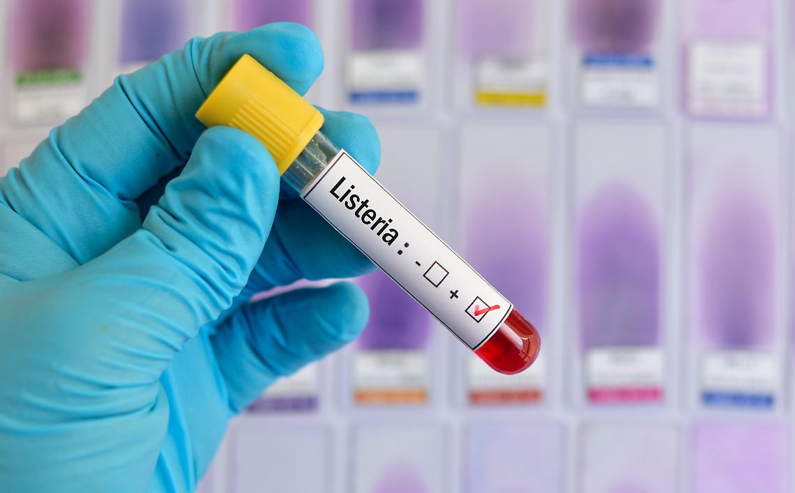 Non segnalarono carne con listeria, arrestati due veterinari