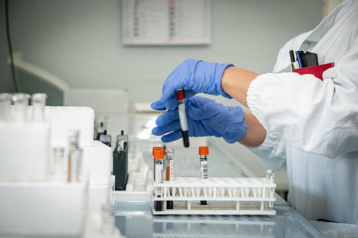 Vaiolo delle scimmie, 85 casi in Ue: sintomi lievi, come si trasmette