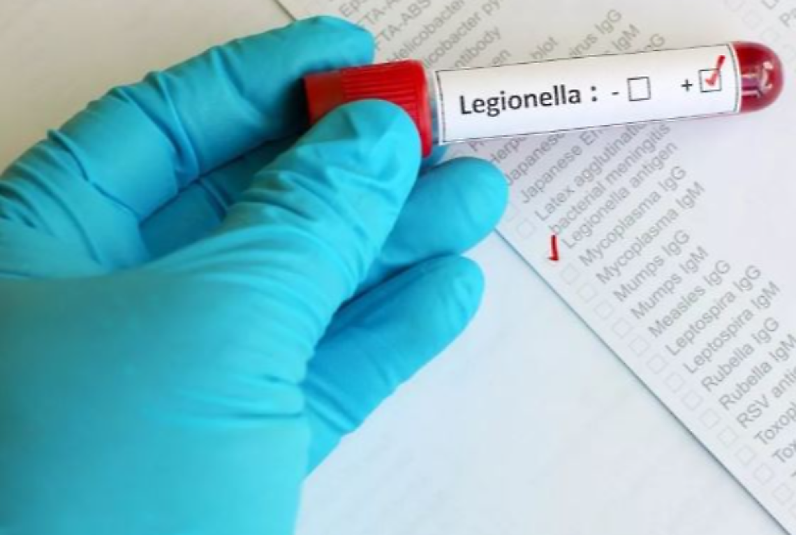 Legionella, 65enne muore dopo 4 giorni di ricovero: era stato in vacanza a Ischia