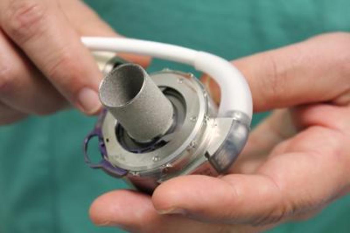 Cuore magnetico salva 16enne, record al Bambino Gesù