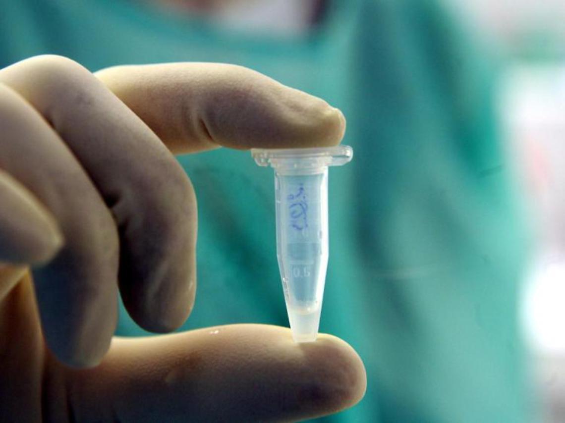 Vaiolo delle scimmie, salgono a 5 i casi in Italia