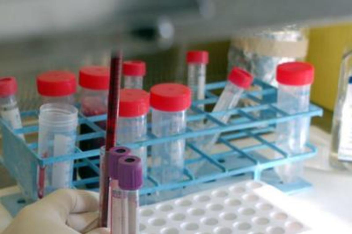 Coronavirus: primi casi in Liguria, Toscana e Sicilia