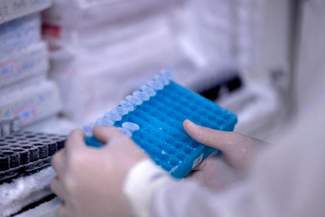 Vaiolo delle scimmie e quarantena: cosa dicono Bassetti, Gismondo, Pregliasco
