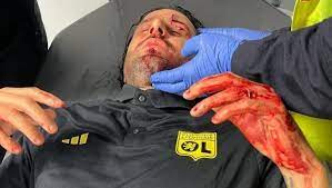 Sassi sul pullman del Lione: ferito l'allenatore Fabio Grosso. Rinviato il match col Marsiglia