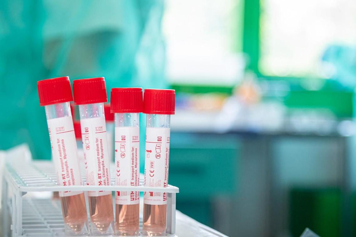 Report Covid: «Virus circola ancora, nuovi focolai»