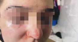 Aggredita e filmata dalle compagne di classe, la madre denuncia