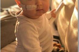 Trapianto riuscito, il piccolo Alex torna a casa