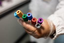 Campania, da lunedì test sierologici nei laboratori privati