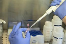 Covid, diabete dopo forma asintomatica: il caso di un 19enne