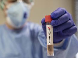 Covid, in Campania 736 positivi, 1 decesso e 5.477 tamponi
