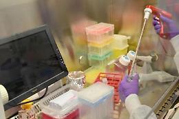 Coronavirus, primi due casi positivi in Valle d'Aosta