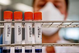 Coronavirus, altri 5 positivi ad Afragola: i contagiati salgono a 29