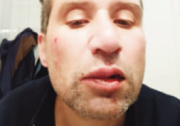 Violenza urbana, pestato a sangue perché va piano con lo scooter