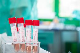 Covid in Italia, la richiesta delle Regioni: asintomatici fuori da calcolo casi