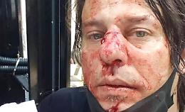 Fotoreporter napoletano pestato durante manifestazione a Londra