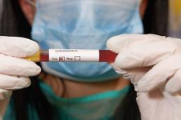 Forte aumento di contagi in Italia: 523 nuovi casi e 6 morti