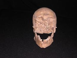 L’ultima rotta di Plinio il Vecchio: il presunto cranio tra curiosità scientifica e solidarietà civile