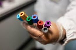 Coronavirus in Campania, stop ai test nei laboratori privati
