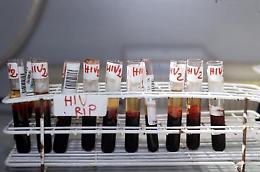Sieropositivo infettò volutamente le partner: 57 i casi di contagio
