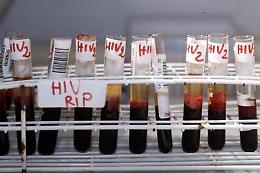 Malato di Aids adescava anche minori per contagiarli, Calderoli: reato di epidemia anche per Hiv